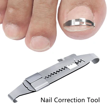 

Ingrown Toe Nail Correction Tool Toenail Straightening Correctors Patch Tool Inset Buckle Pressure Sensitive Tape Pedicure Tool