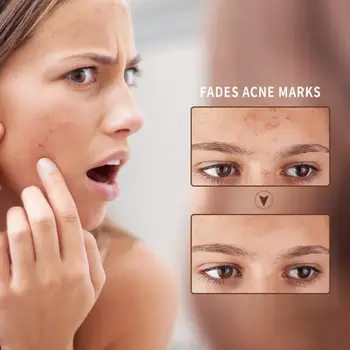 

50ml Natural Aloe Vera Gel Moisturizing Acne Treatment Cream Capsule Whitening Anti Face Care Skin Cream Design Winkle Q6S1