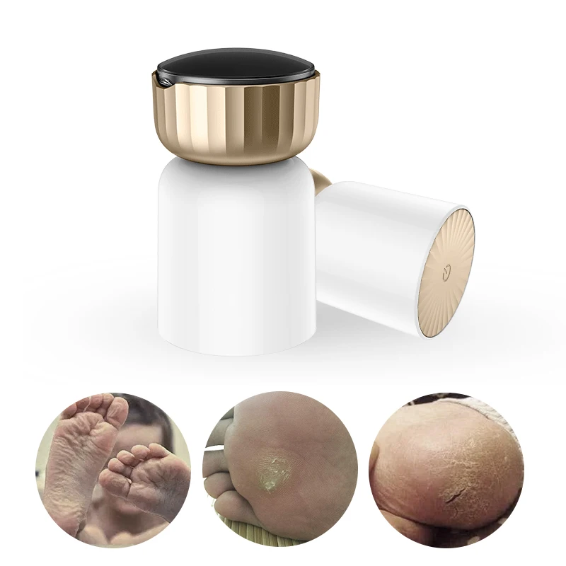 

Electric Pedicure Tools Foot File Heels Grinder Dead Skin Callus Remover for Foot Pedicure Tools Feet Care Foot Grinding Machine