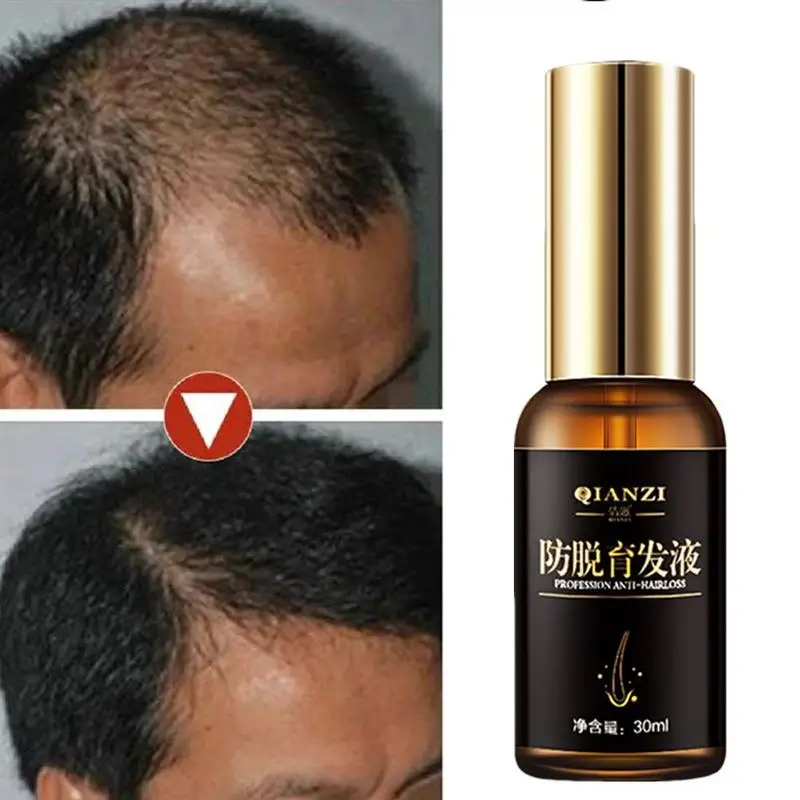 Сывороточная эссенция для быстрого роста волос против потери волос, жидкие эфирные масла для восстановления поврежденных волос для женщин и мужчин, уход за волосами