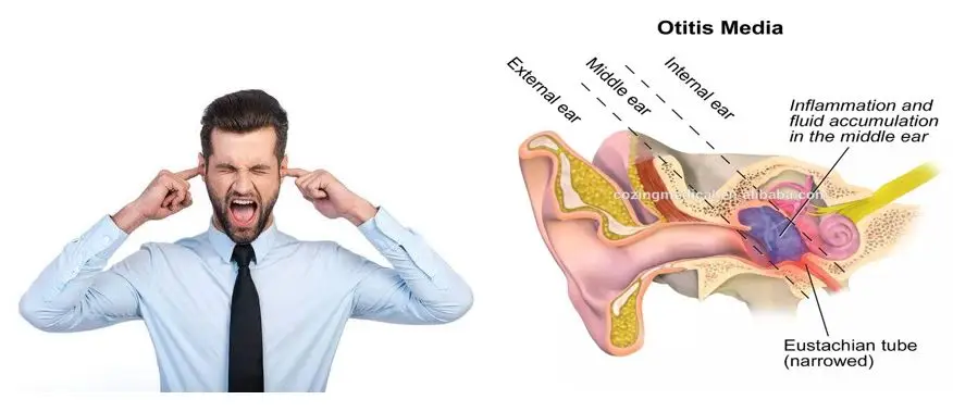 Clearance Tinnitus Ear Laser Therapy Watch Laser Acupuncture Machine Tinnitus/ Otitis/ear hearing problem 5