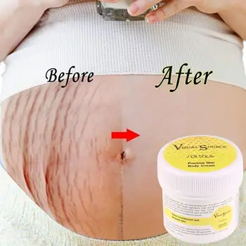 

Stretch Mark Cream Smooth Repair Cream Non-irritating Natural Removal Care Scar Skin Mild Effective Repair Pregnancy Postpa I2F9