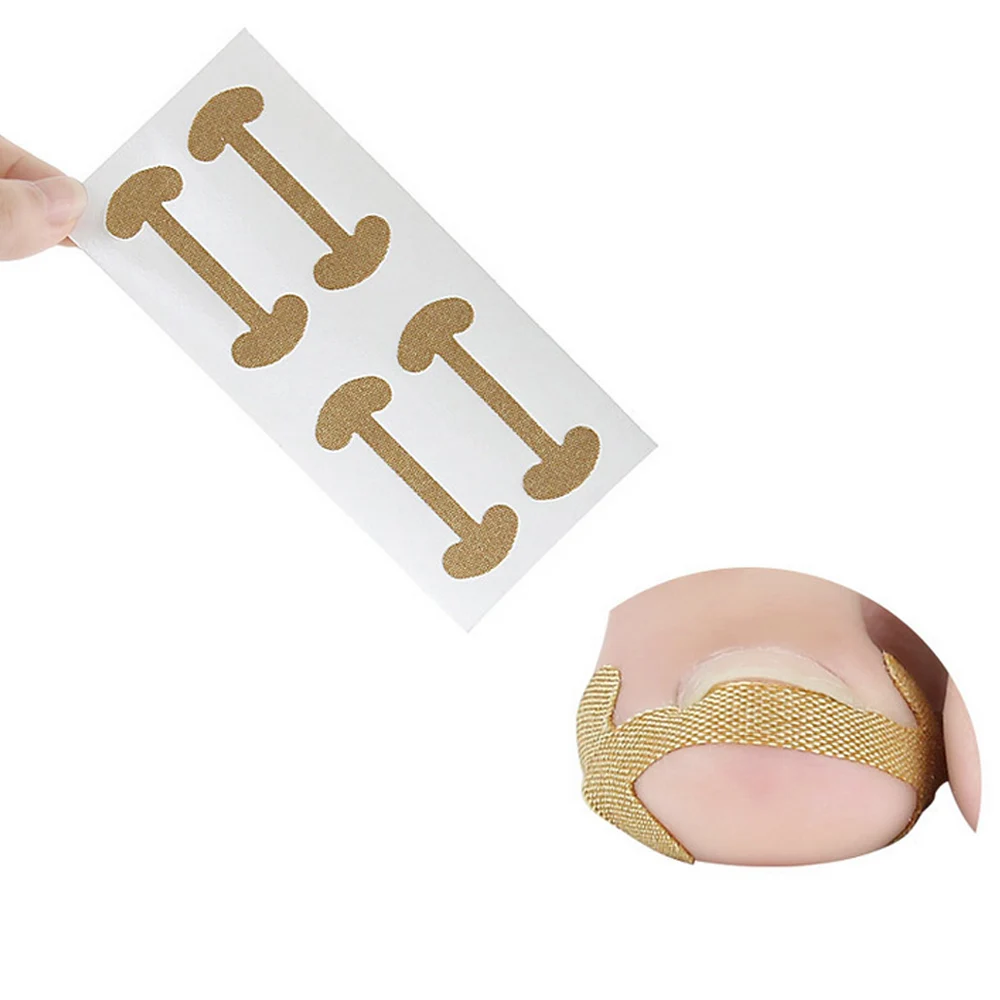 8PCS Ingrown Toenail Nail Correction Stickers Paronychia Treatment Recover Corrector Fingernail Nails ingrown Correction Patches