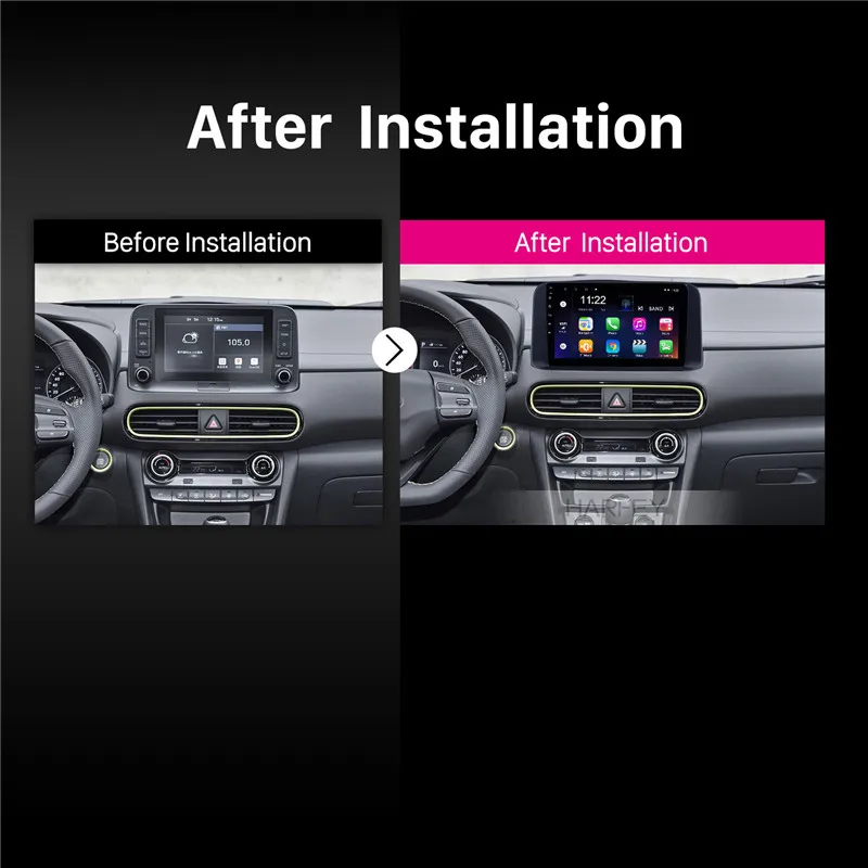 Excellent Harfey 10.1inch Android 8.1 for Hyundai ENCINO Kona 2018 2019 HD Touchscreen car GPS Radio AUX Carplay 3G Steering Wheel Control 2
