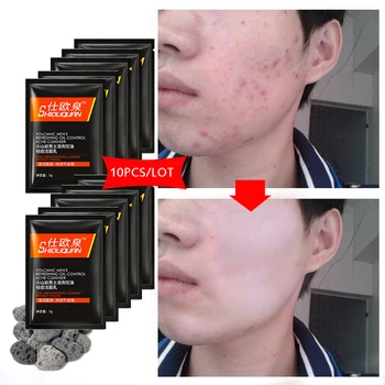 

Face Skin Care Washing Men Product Oil-control Moisturizing Facial Cleaner Remove Acne Pore Cleanser Anti Aging Cleansing