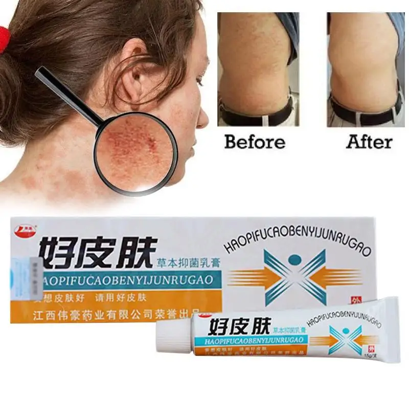 1PCS Skin Psoriasis Cream Dermatitis Eczematoid Eczema Ointment Treatment Care Skin Psoriasis Cream Cream Body Dropshipping O9X4