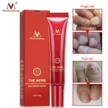 Травяные Лечение ногтей противогрибковые инфекция ногтей ремонт крем для ногтей маникюр питательный питание ног защита ножницы для педикюра масло