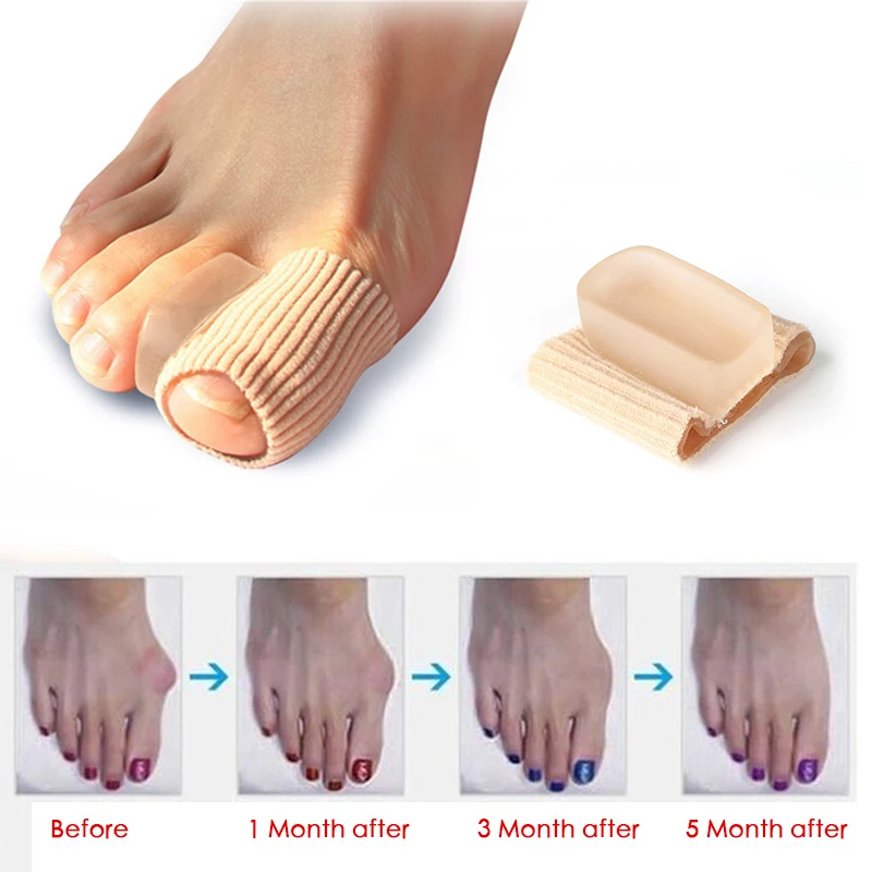 Силиконовые повязки вальгусная коррекция большого пальца 2 шт. корректор для косточки на ноге для пальцев большого пальца ноги разделитель для ноги инструмент для ухода