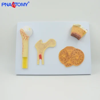 

Enlarged skeleton bone model periosteum, blood vessels, spongy bone, compact bone and haversian system femur model medical teach