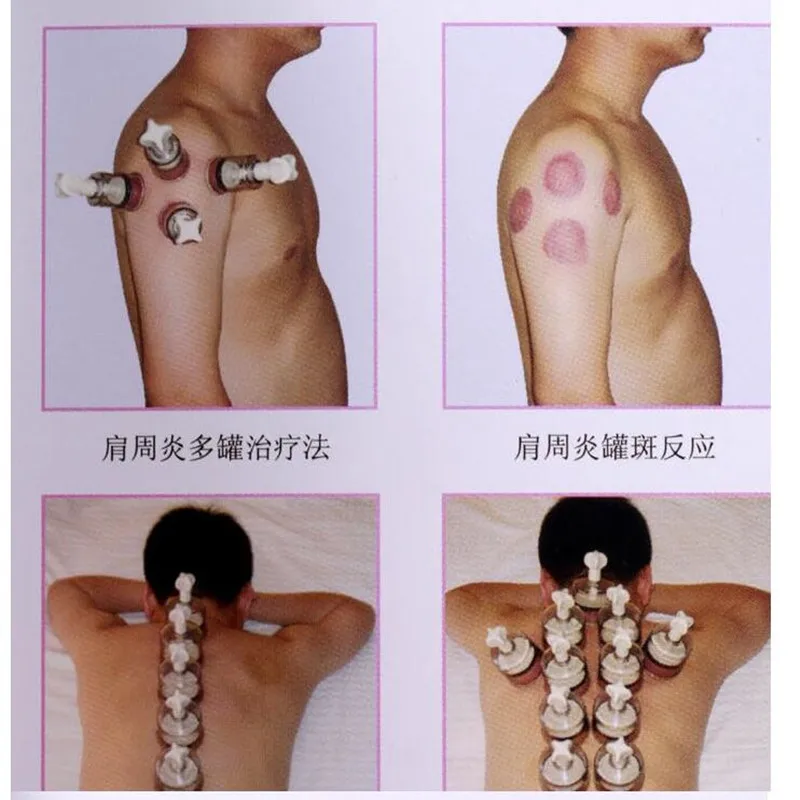 12 шт. Набор вакуумных чашек на присоске с магнитом массажные резервуары мыльной