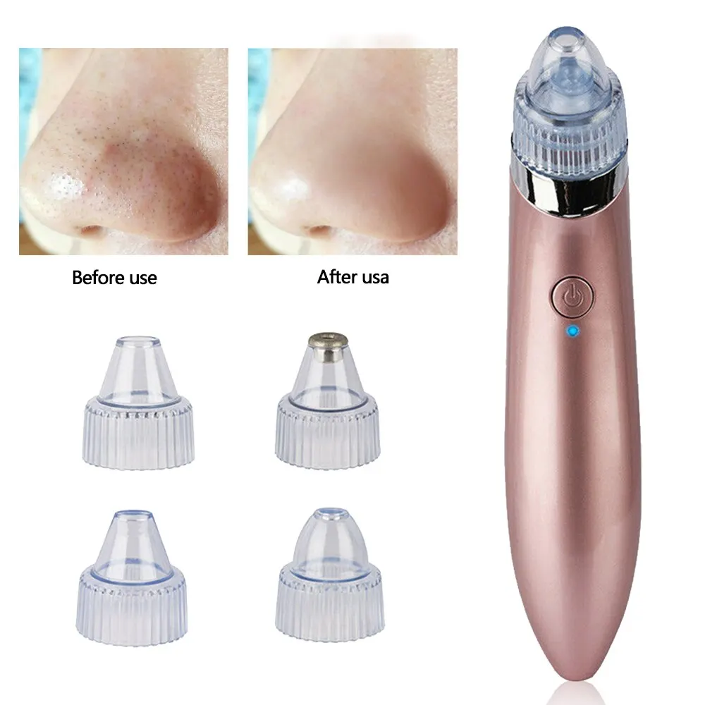 

Blackhead Remover Face Deep Nose Cleaner Skin Care Facial Pore Cleaner Vacuum Suction Tool Acne Pimple Removal Cleaner Machine