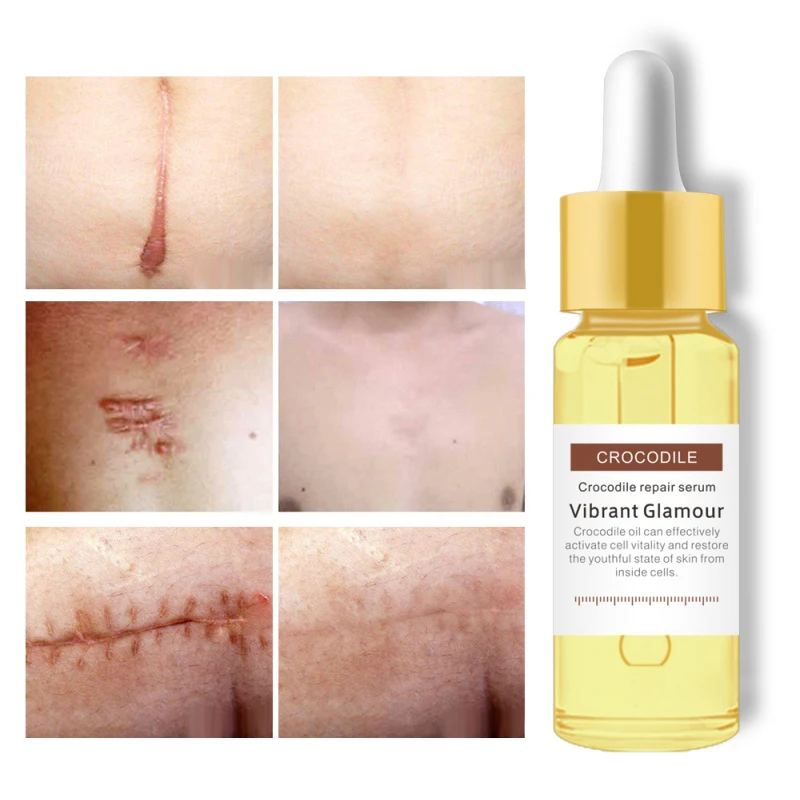

VIBRANT GLAMOUR 15ml Crocodile Peptide Face Serum Effective Remove Scar & Repair Damaged Skin Moisturizing Acne Treatment TSLM1