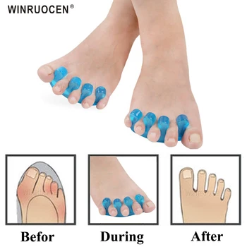 

Hot Silicone Toe Separators Fingers Foots Spacer Gel Soft Beauty Tools Polish Manicure Pedicure Pads Thumb Tip Foot Care Tool