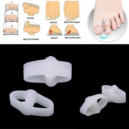 2 Pcs Soft Silicone Toe Straightener Separator Bunion Corrector Pain Relief Foot Care Tool Hallux Valgus Correction Pedicure