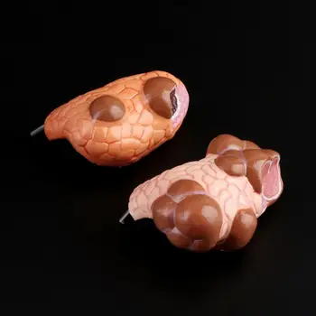 

Human Thyroid Anatomical Pathology Model Normal and Disease Pathologies Medical Teaching Resource Tool D08B