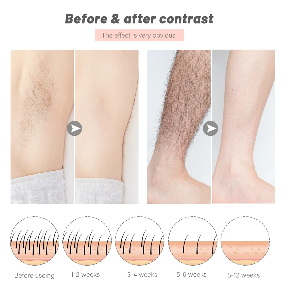 Dispositivo de Remoção do Cabelo Flash Laser Photon Indolor Depilador Ferramentas Permanente Lcd Elétrico Lábio Perna Removedor Cabelo Dispositivo 900000 Ipl 9 Depiladores
