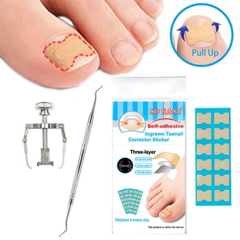 

Ingrown Nail Correction Kit Ingrown Toenail Stickers Toe Nail Clamp & Lifter Straightening Treatment Recover Corrector Toe Nail