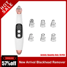 Угорь аспиратор точка вакуумный экстрактор для Лица Глубокой черных точек, Чистка Пор, CleanElectric акне прыщи присоски