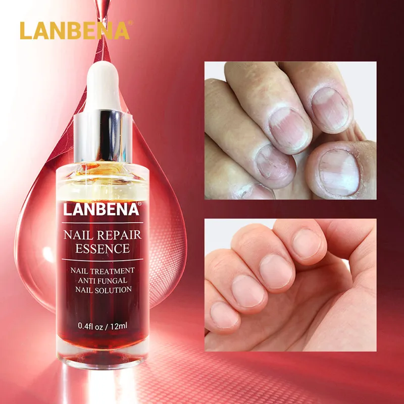 Эссенция для ремонта ногтей LANBENA сыворотка лечения грибков и удаления