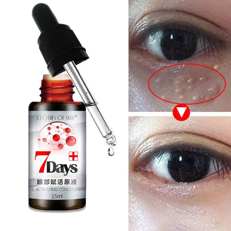 

Natural Eye Serum Cream 7 Days Remove Dark Circle Bags Under The Eyes Prevent And Improve Fat Particles Improve Skin Appearance