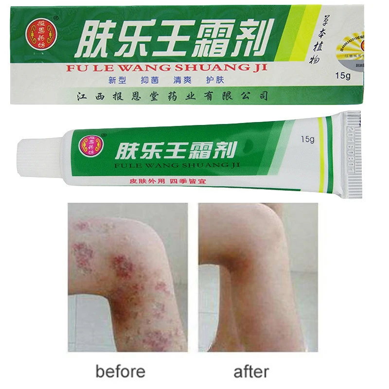 

3CT002 1pc Chinese Analgesic Balm Ointment Psoriasis Cream Herbal Skin Topical Antipruritic Ointment Cream Body Massage Patches