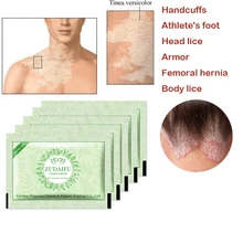 10Bags Zudaifu Skin Psoriasis Cream Dermatitis Eczematoid Eczema Ointment Treatment Psoriasis Cream Skin Care Cream
