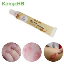 1pcs Hua Tuo Anti-infection Cream Antibacterial Burn Wound Care Ointment Burn Better Faster Inhibit Herbal Medical Plaster S010