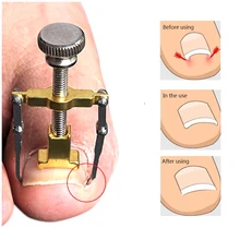 1 шт., инструмент для коррекции вросших пальцев ног из нержавеющей стали, ортодонтическое приспособление для пароникьи, встроенные продукты для ногтей, набор для ногтей