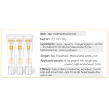 Гель для ухода за ногами, отбеливание пальцев ног, удаление грибка, ремонт ногтей, эссенция WSH99