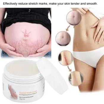 

120g MELAO Pregnancy Scars Remove Acne Cream Stretch Marks Treatment Maternity Repair Natural Ingredients Slimming Products