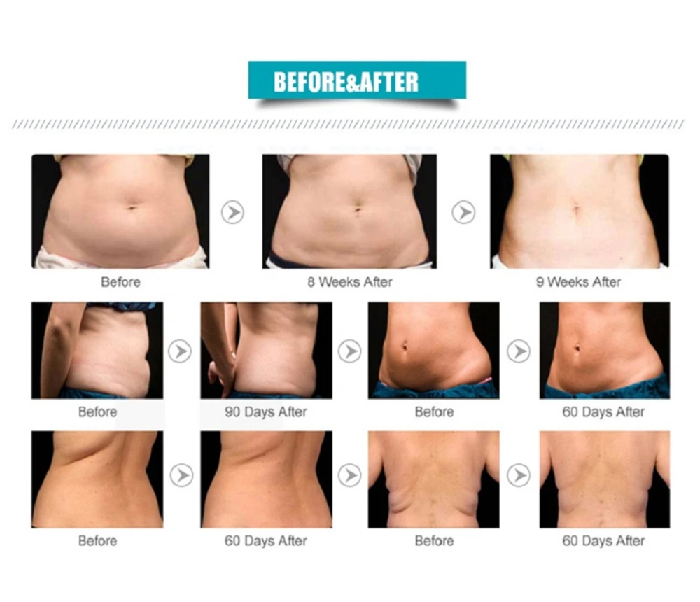 HTB1pQtYXBv0gK0jSZKbq6zK2FXam