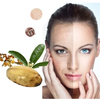 

Soaps powerful acne remover! 120g Pure plant essential oil soap acne treatment and Remove whelk shrink pore face care soap