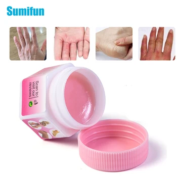 

Sumifun Anti Dry Anti-crack Cream Hand/Foot Cream Winter Anti Frozen Frostbite Dead Skin Repair Ointment Moisturizer Cream