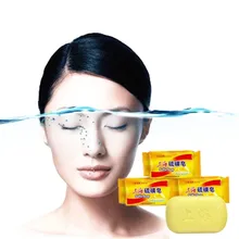 85 г шанхайское лекарственное мыло. Противовоспалительное, антисептическое и очищающее мыло от кожных заболеваний. Лечения псориаза