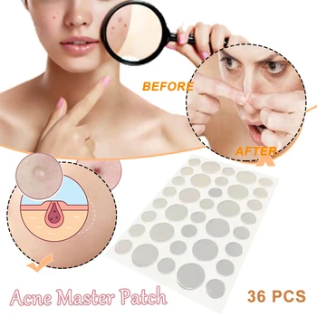 

Fibroepithelial Polyp Removal Patch (36 Pcs)