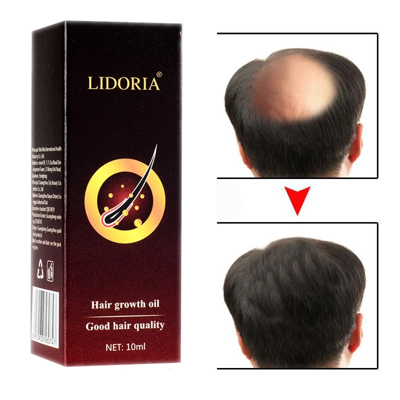 Эфирные масла для быстрого роста волос оригинальная эссенция ухода за волосами