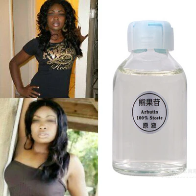 30ml blanqueamiento de la piel rayo brillo suero Ácido Kójico suero blanqueamiento mancha crema