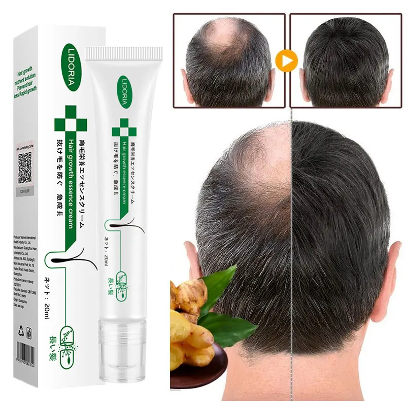 Ginger Hair Growth Essential Oil Serum Anti Loss Fast Grow Repair Massage Roller Treatment Prevent Baldness Dry Care | Красота и