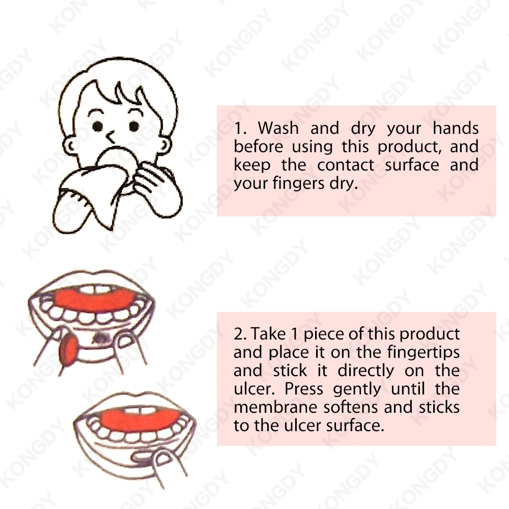 Oral Canker Sore Stickers Effective Mouth Ulcer Treatment Mouth Sole Cover Patch Fast Healing Safe Antibacterial Film 6PCS/BOX