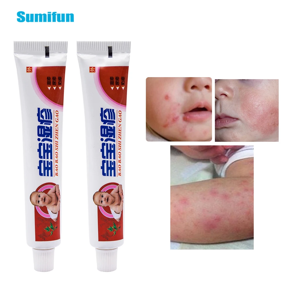 Sumifun детская кожа псориаз Pruritus дерматит крем мазь против зуда китайская травяная