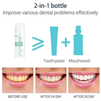 

Oral Hygiene Whitening Foam Toothpaste Cleaning Mousse Toothpaste Removes Plaque Probiotics Stain Removal