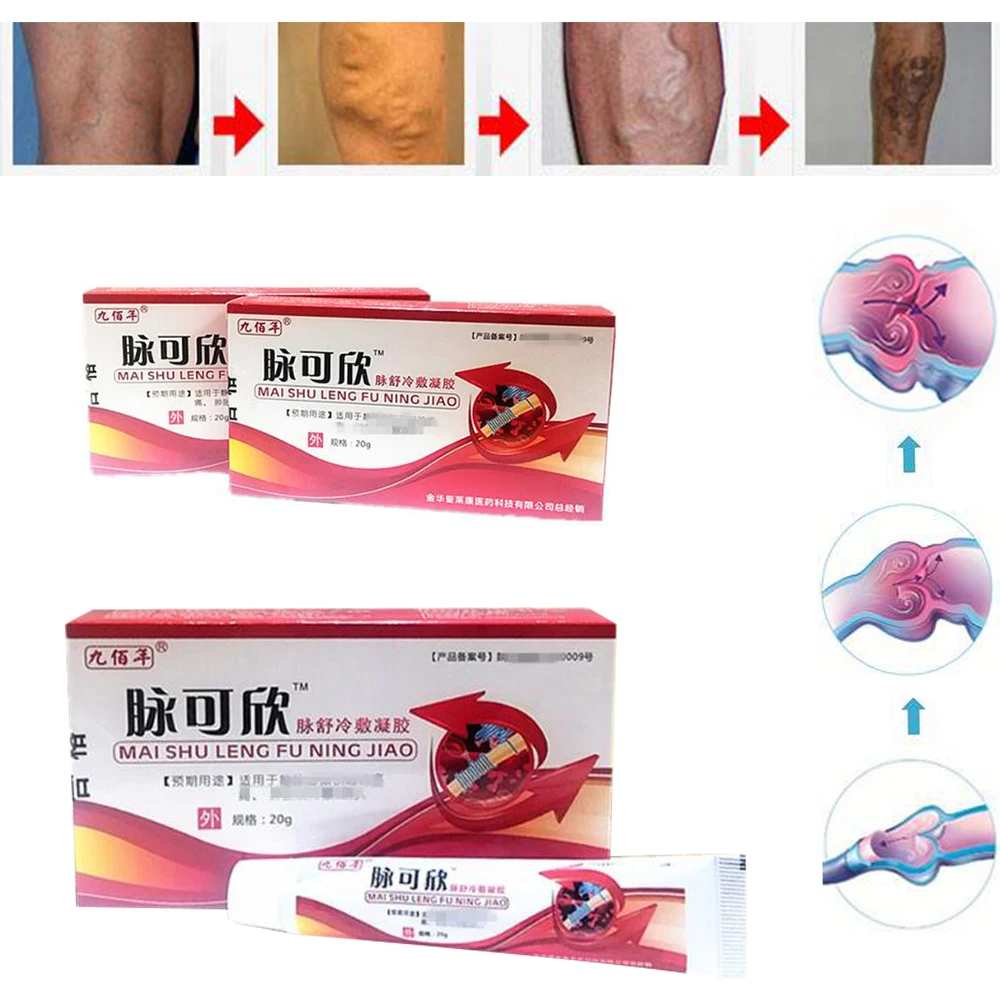 HTB1ohswaErrK1RkSne1q6ArVVXaL