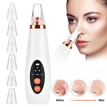 Черный точек вакуумный аппарат для очистки пор нос черная точка удаления угрей прыщи для удаления, всасывающий экстрактор для лица Инструм...