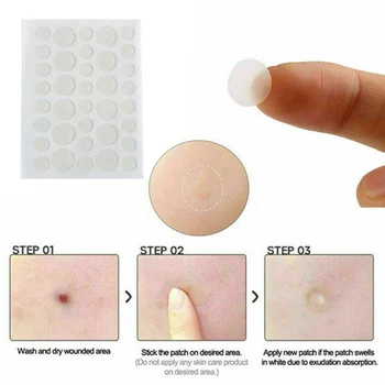 

36pcs Remover Round Hydrocolloid Transparent Invisible Acne Patch Wound Recover Teenagers Low Stimulus Absorb Exudation Skin Tag