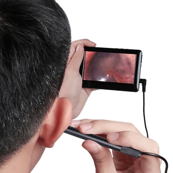 

Ear Cleaning Endoscope 2 In1 USB HD Visual Ear Spoon 5.5mm Mini Camera Ear Pick Nasal Borescope Otoscope Camera