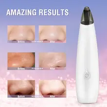 3 средство для ухода за волосами черный инструмент для удаления черных точек и прыщей очиститель лица эффективный волшебный акне удаление прибор для лица Очищающий Инструмент для массажа