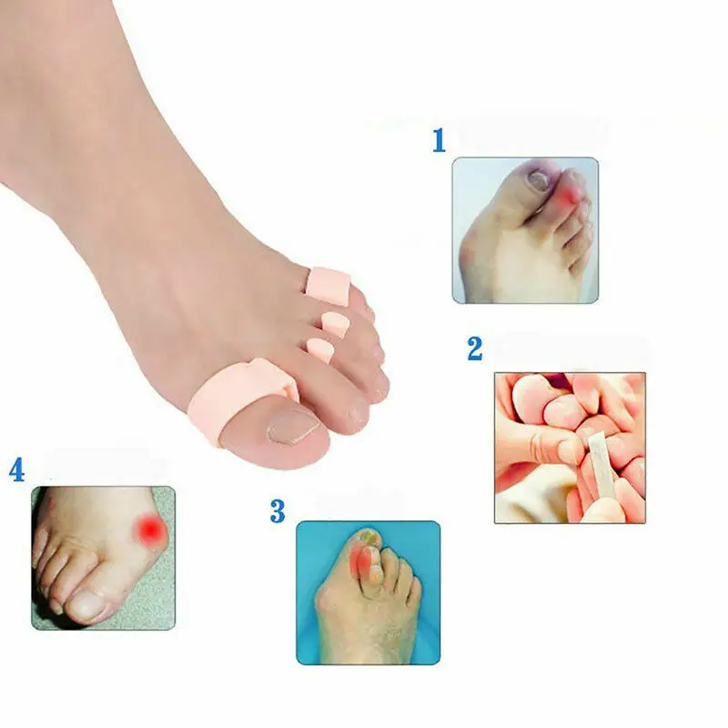 1 Pair Toe Separators Orthopedic Bunion Corrector Finger Toe Separators Hallux Valgus Elastic Straighteners Pads Foot Care Tool 1 Pair Toe Separators Orthopedic Bunion Corrector Finger Toe Separators Hallux Valgus Elastic Straighteners Pads Foot Care Tool