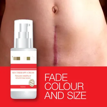 

NEUTRAFADE SKIN THERAPY CREAM REDUCES VISIBILITY OF OLD & NEW SCAR FADE SCAR