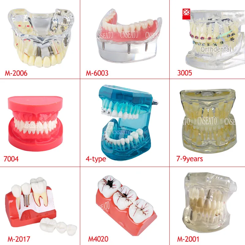 

1 Pc Dental Implant Analysis Crown Bridge Demonstration Teeth Model M-2017