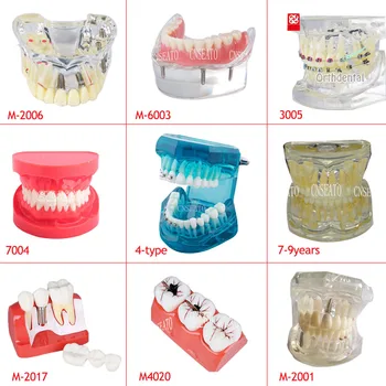 Dental Demonstration Standard Typodont Teeth Model Dental Study Teach Model Demonstration Clear Model with Teaching and Science dental premature disease teeth model transparent caries pathological demonstration tooth child study teaching showing 2018